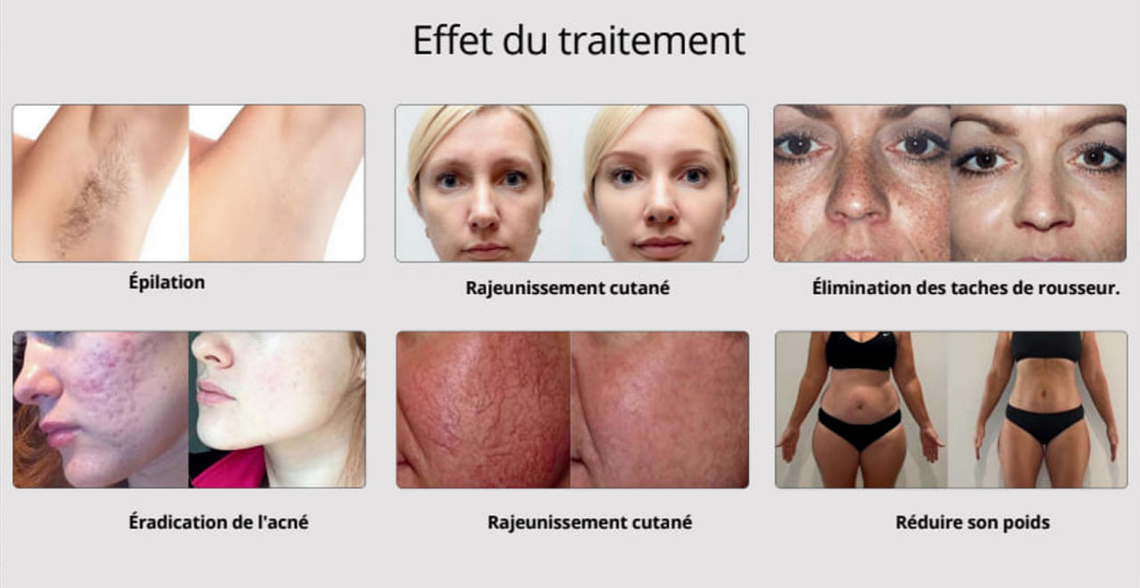 Prisma Advanced 4 en 1