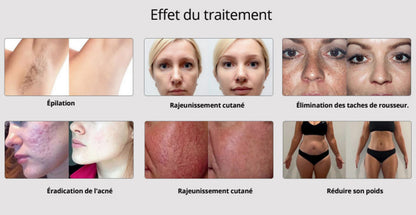 Prisma Advanced 4 en 1